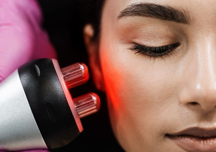 Radiofrecuencia facial 