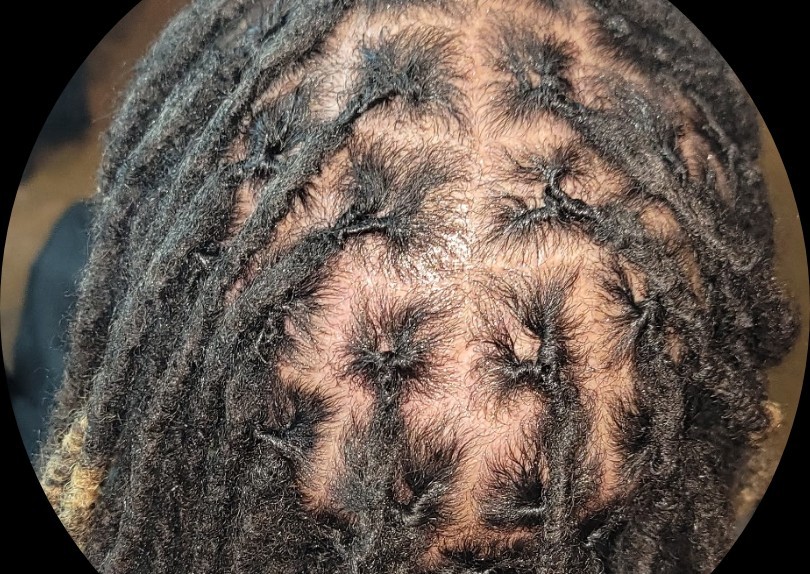 Med~ Locs INTERLOCK (2/2)