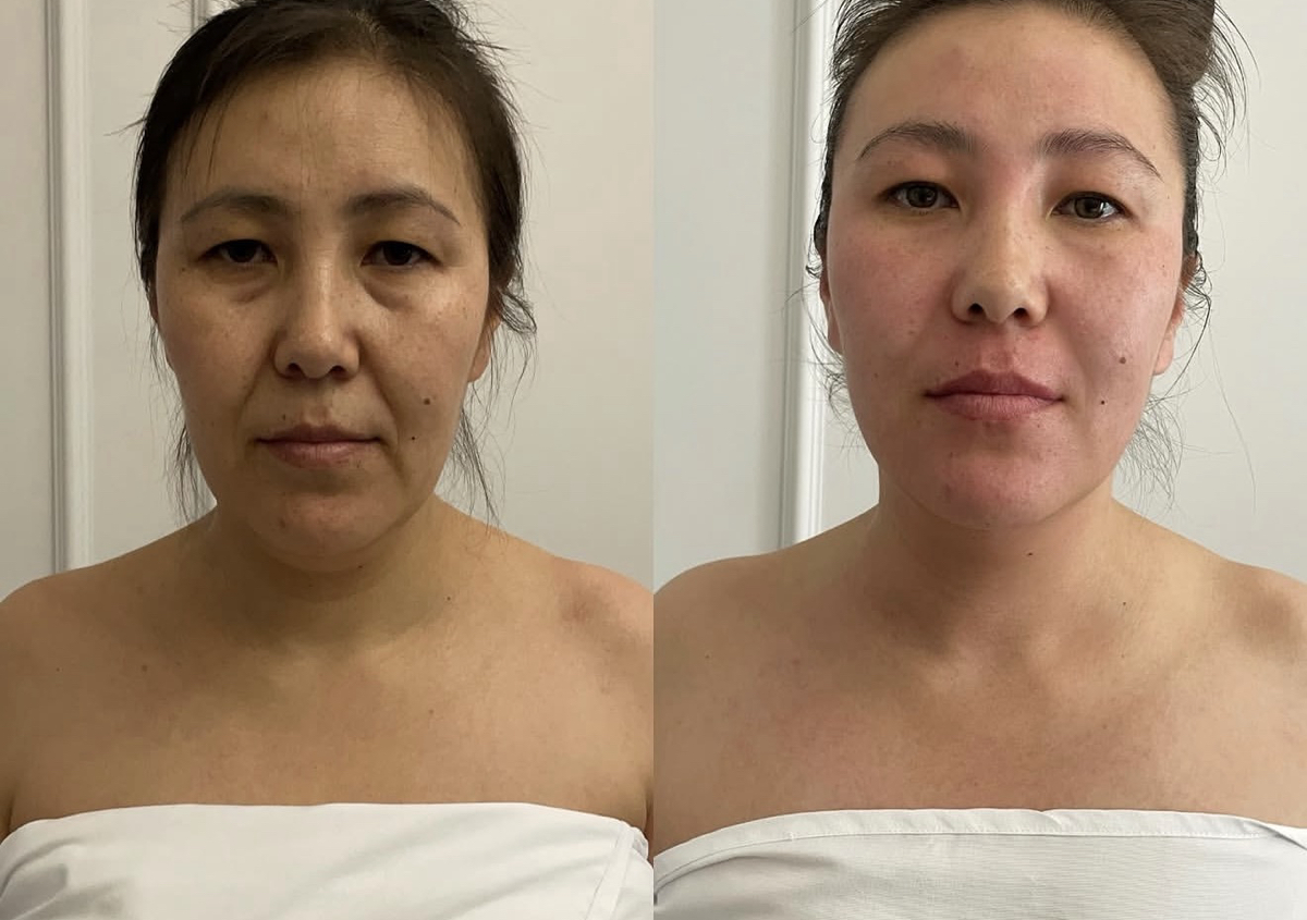 Custom face massage 