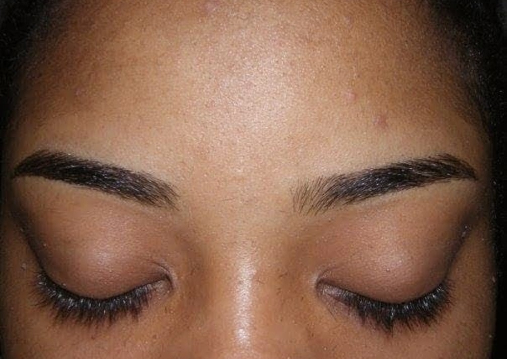Eyebrow Arch