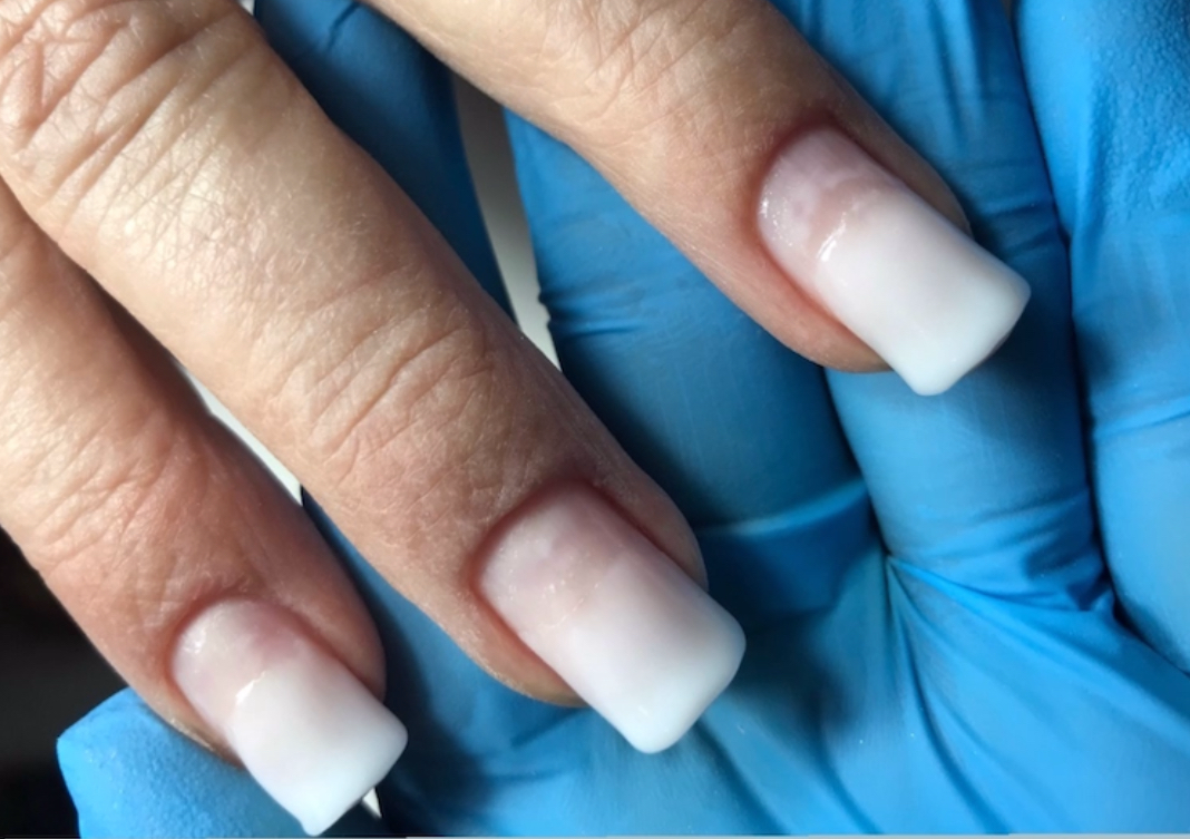 Refuerzo en punta y nivelacion en gel 