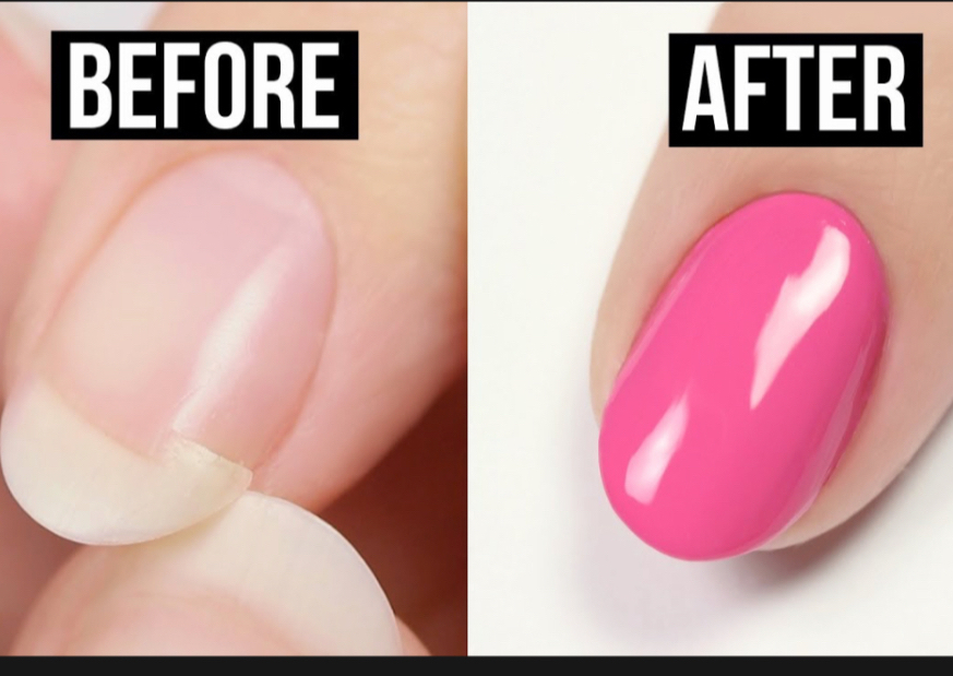 Nails Repair