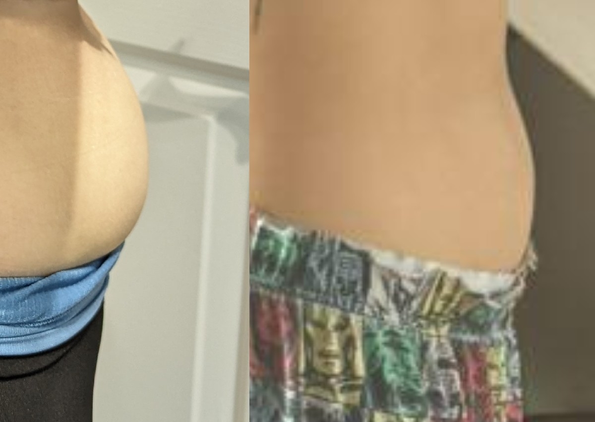 Lemon Bottle large area