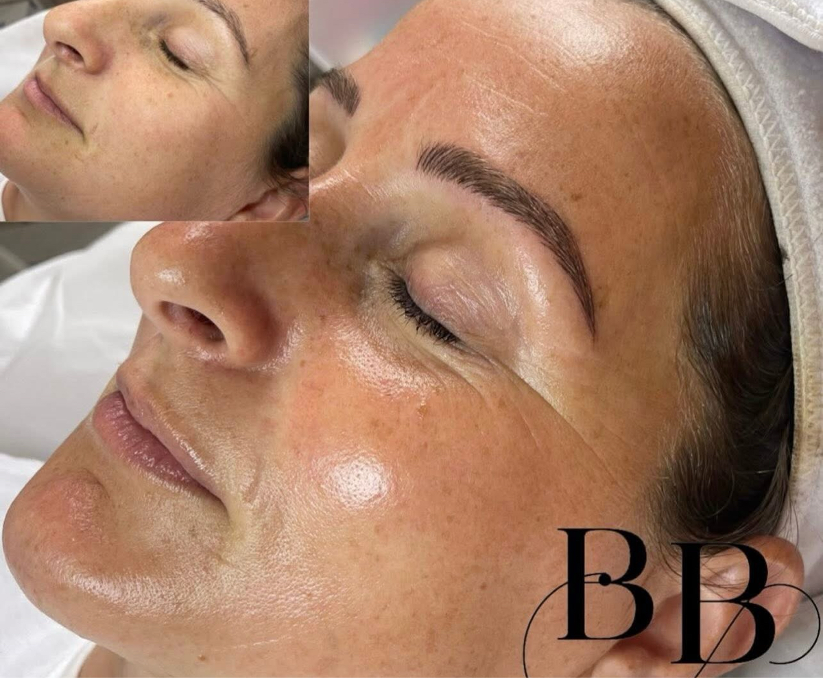 ✨ GLOW FACIL & MASSAGE ✨