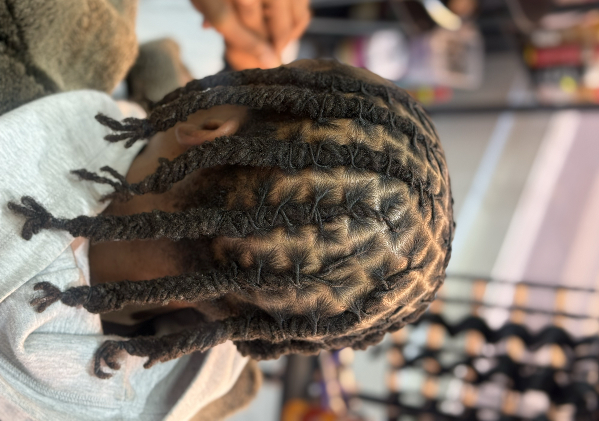 Loc installation (whole head)