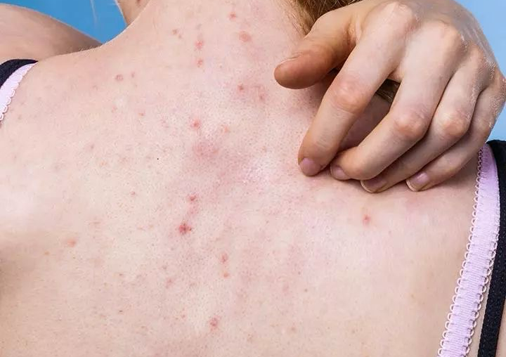 Antioxidant Back Treatment (Espalda)