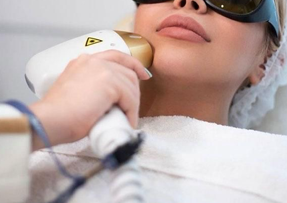 Barbilla (5 sesiones) 