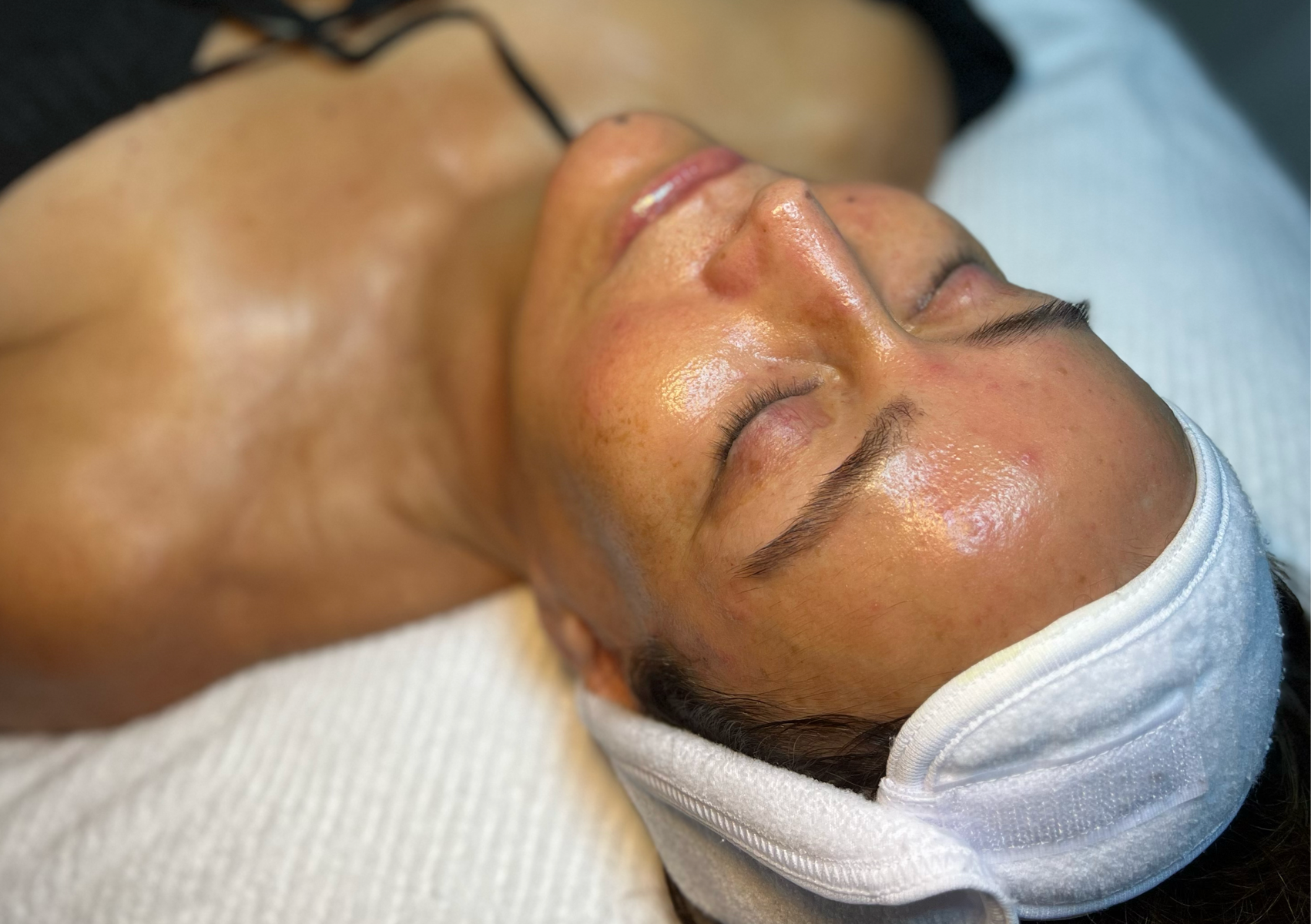BioRe Peel Treatment + Dermaplane (Magic treatment)