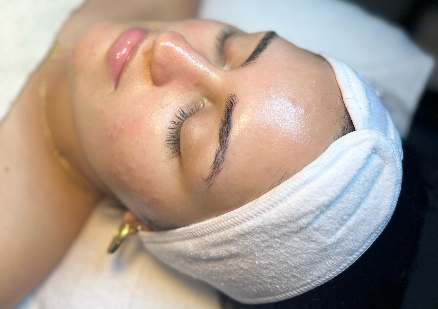 Calm Facial (Rosácea)