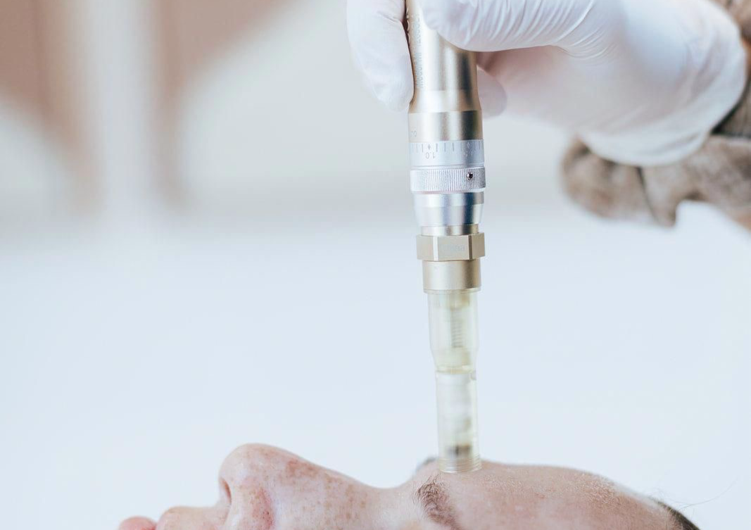 Microagujas (Anti-Aging)