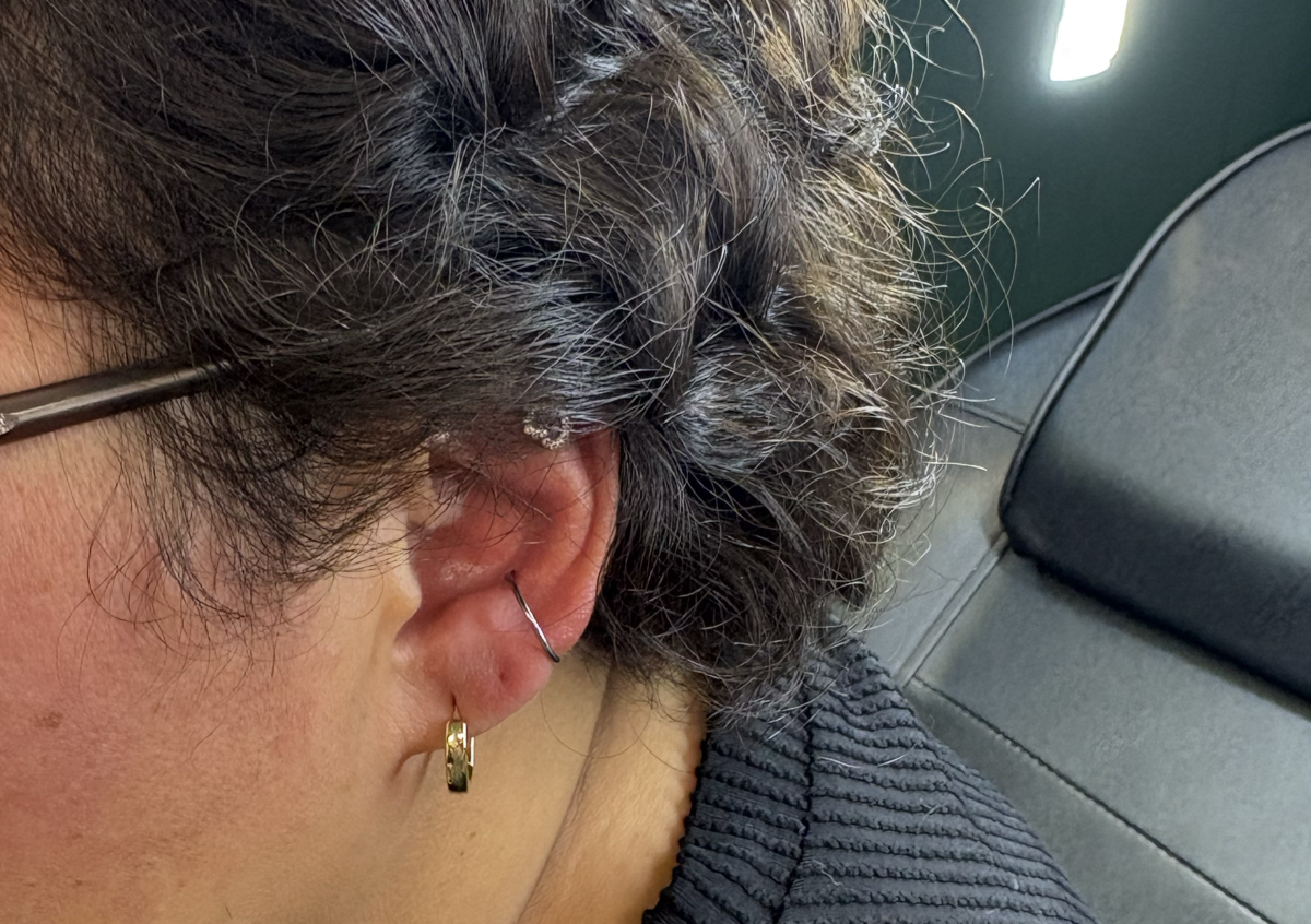 Conch 