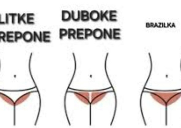 Epilacija žene - duboke prepone