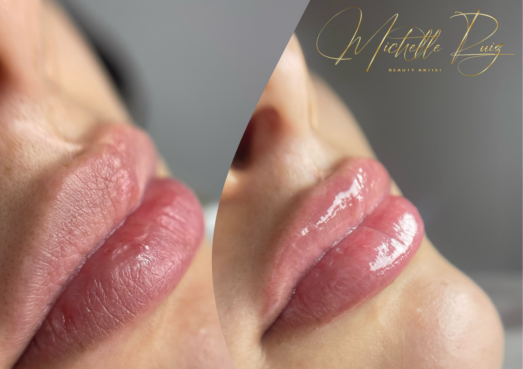 Hydra Lips 