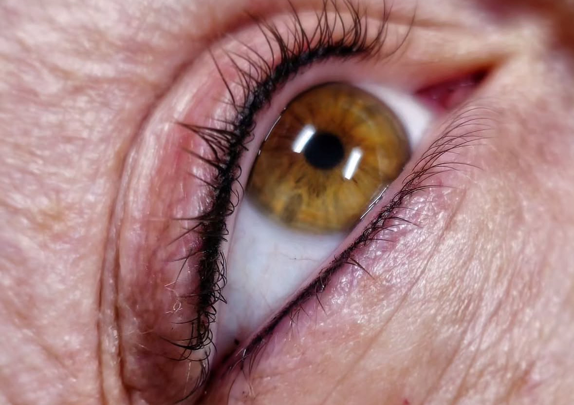 Contorno infracigliare