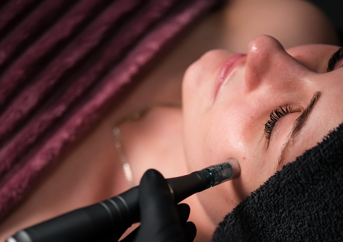 Microneedling (Full Face) 