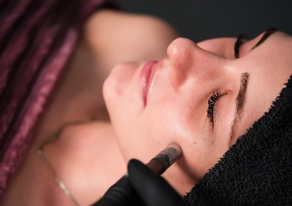 Microneedling (Full face, Neck & Decolletage) 