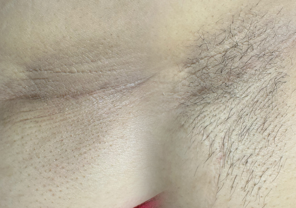 Underarm wax 
