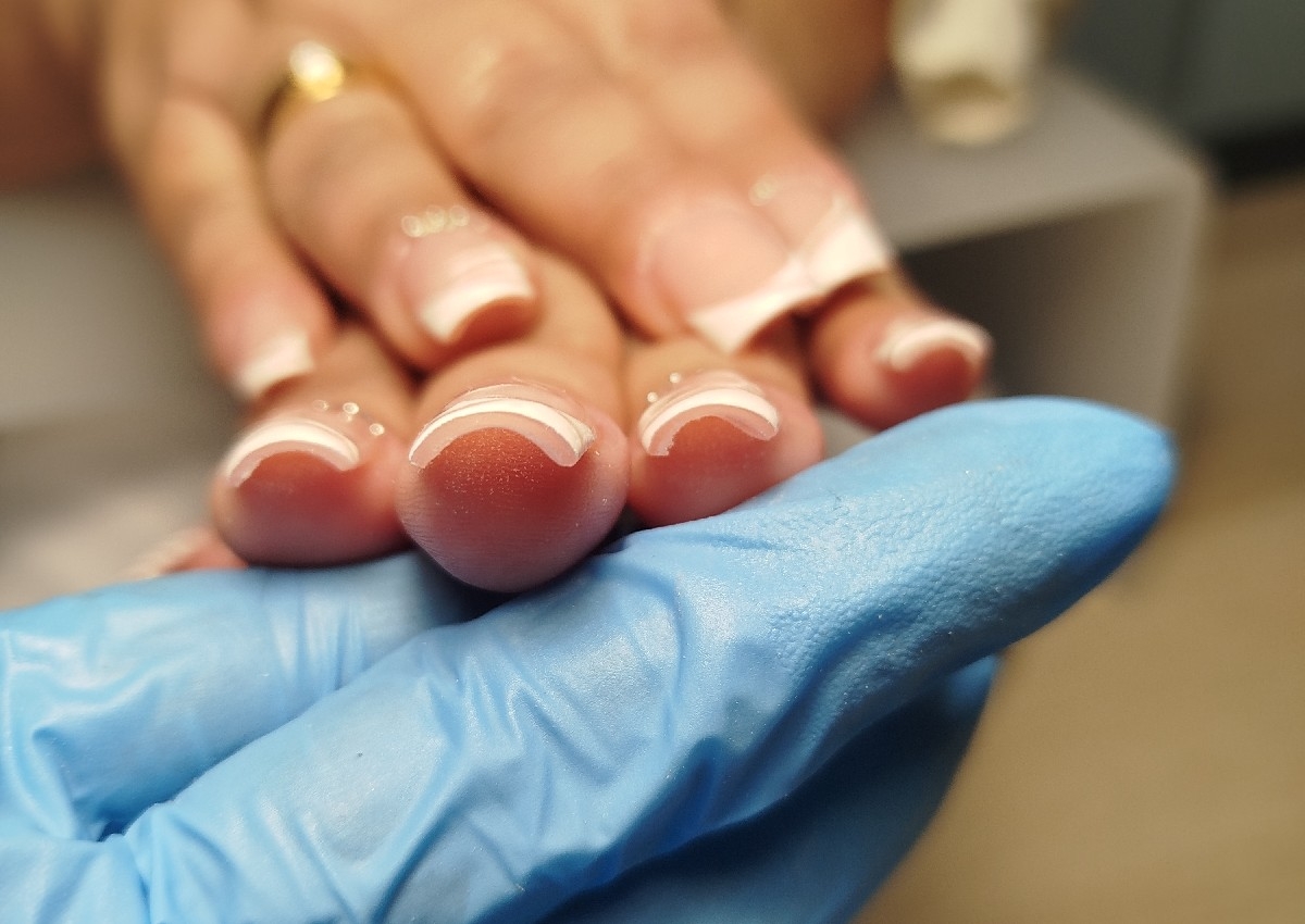 Formação Soft Gel