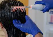 Radio frecuencia capilar (caida y crecimiento)