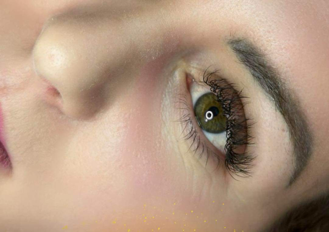 Soft Volum Auffüllung 