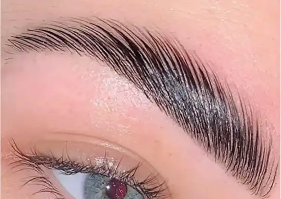 Augenbrauen  Lifting