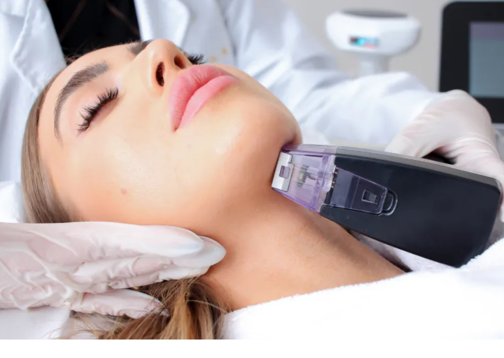 Morpheus 8 con celulas madre