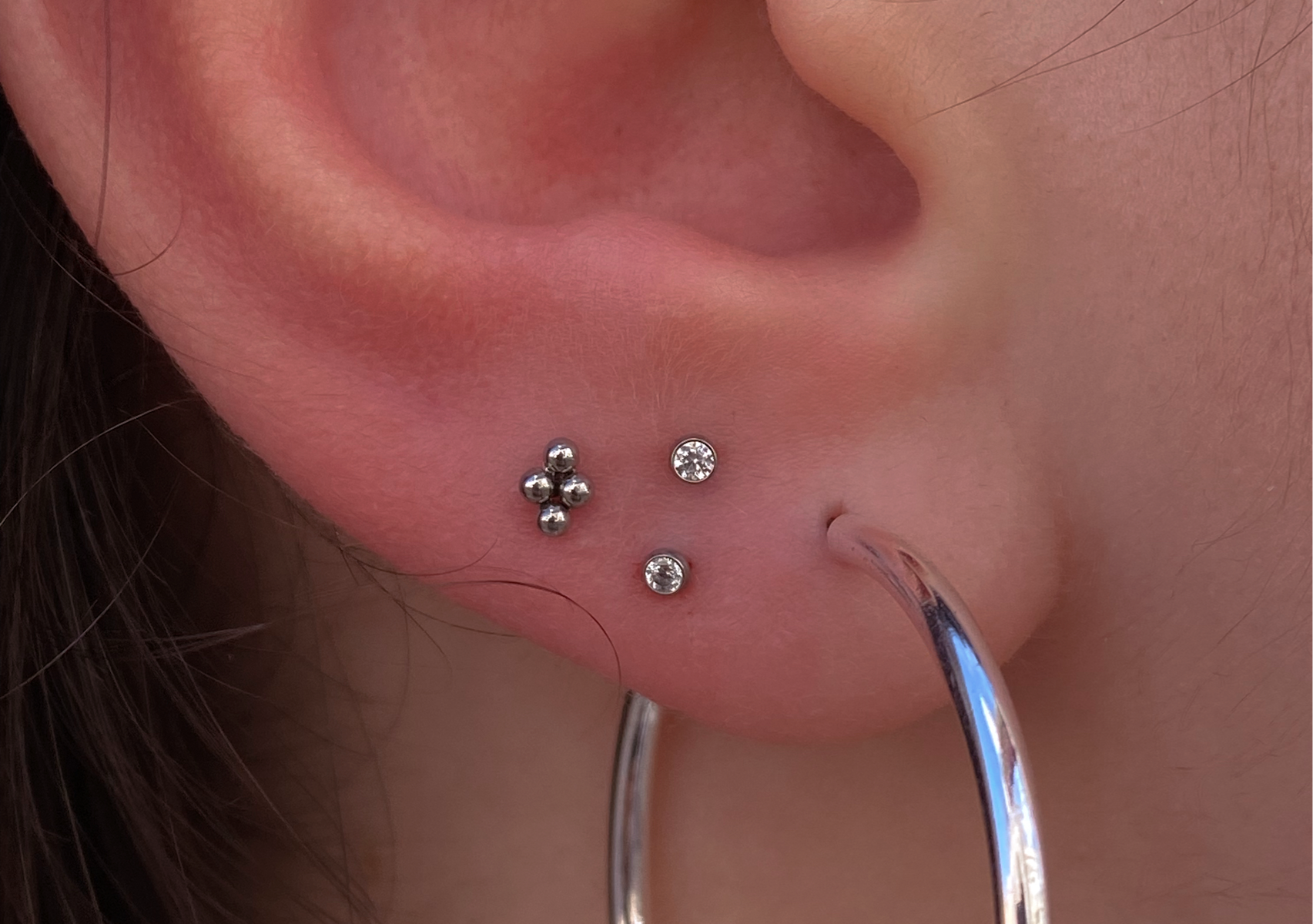 Lóbulo duplo | Double lobe 