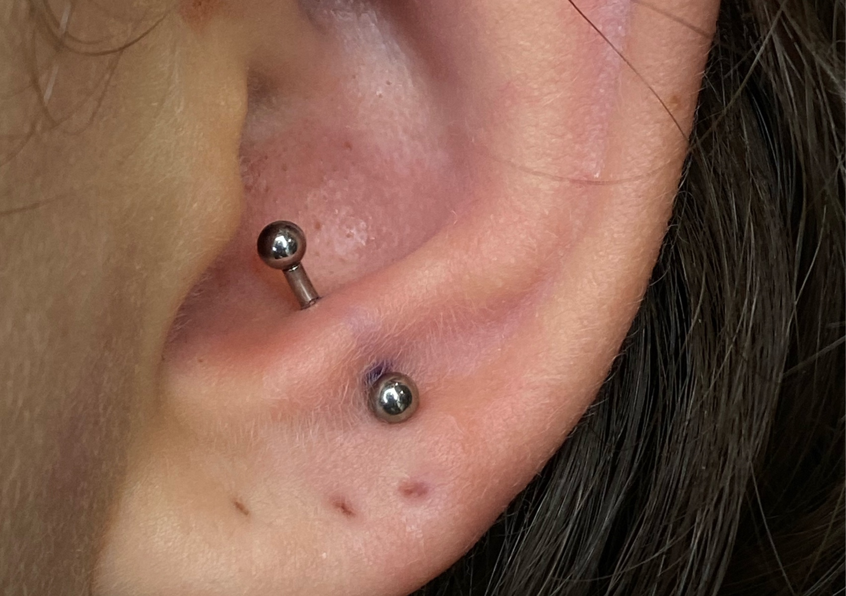 Anti tragus 