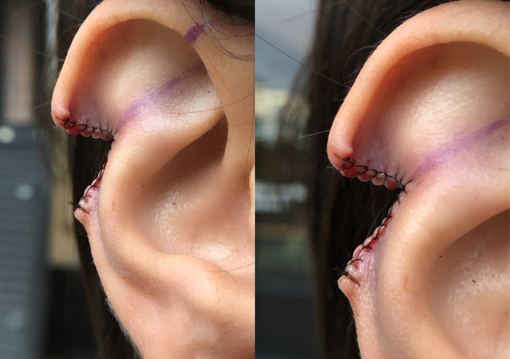 Ear cropping