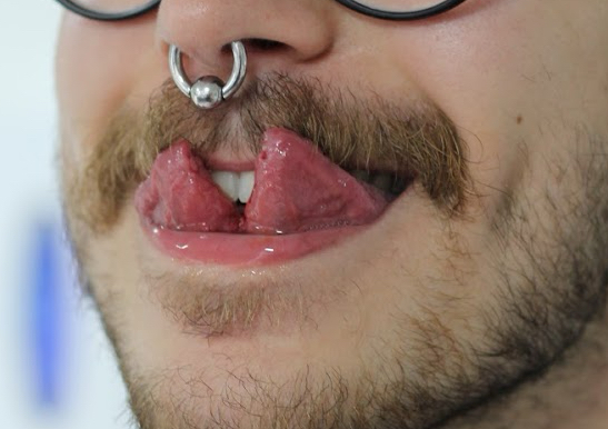 Tongue split