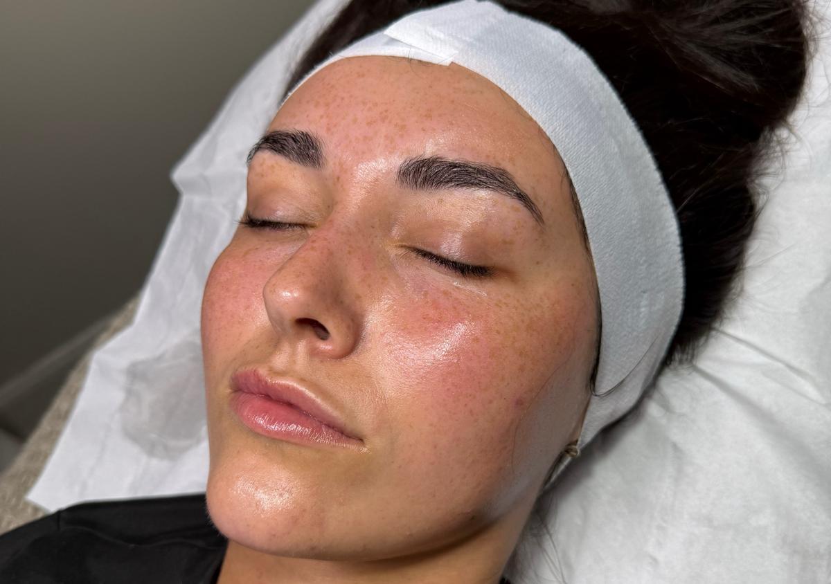 Signature Dermaplane | Solène Skin 