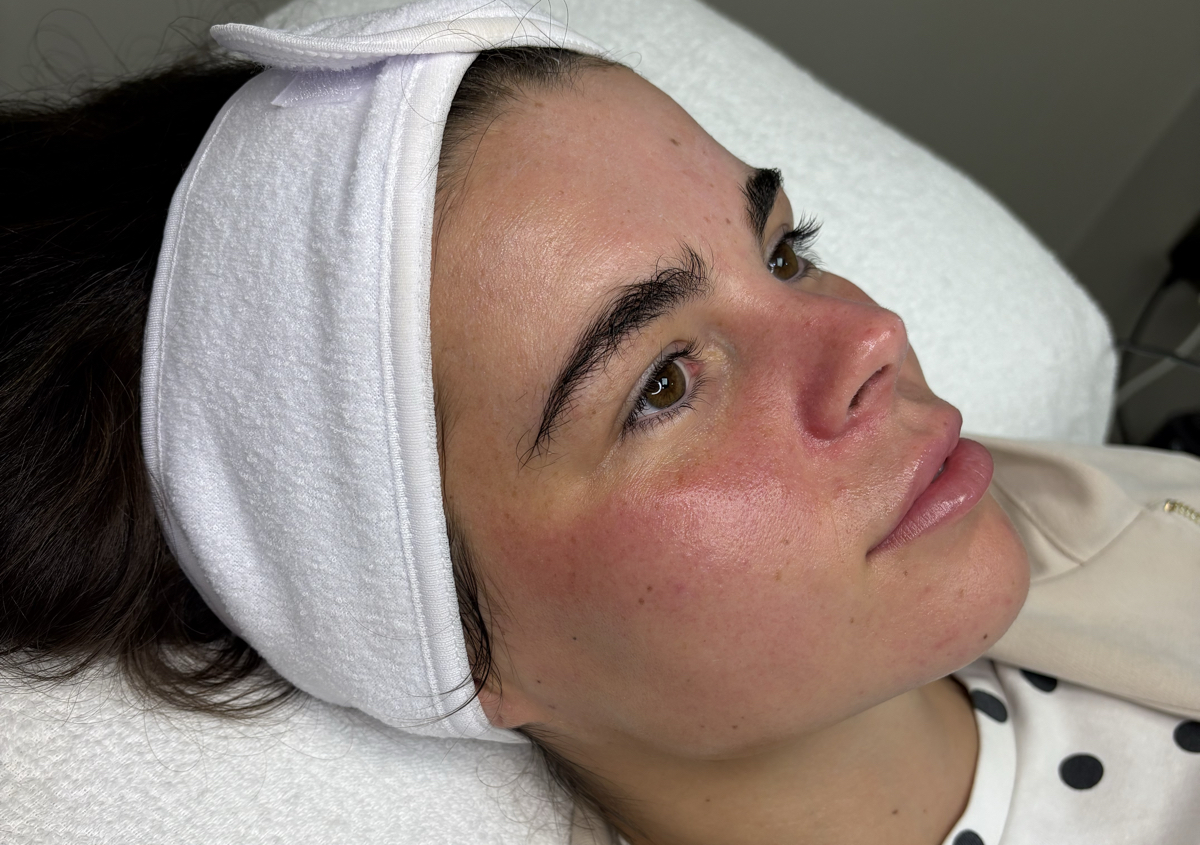 Express Glow Facial | Studio Skin