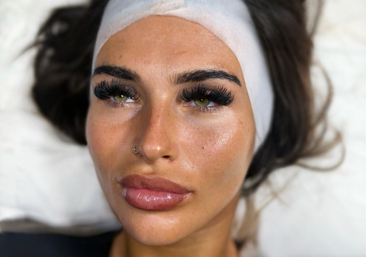 Signature Glow Peel | Solène Skin  (3/3)