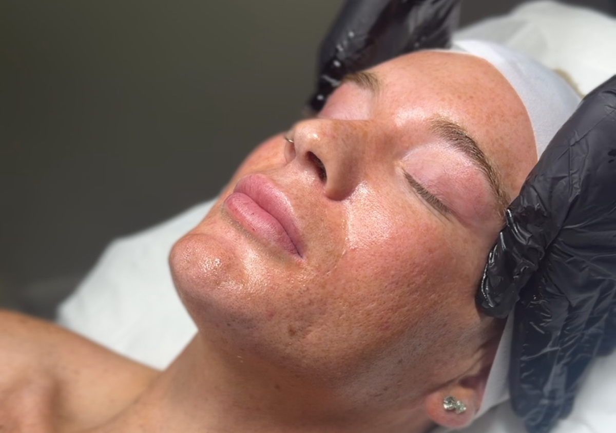 The Brightening Programme Course Of 4  | Solène Skin 