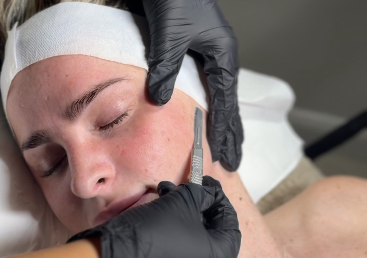 Express Dermaplane | Solène Skin 