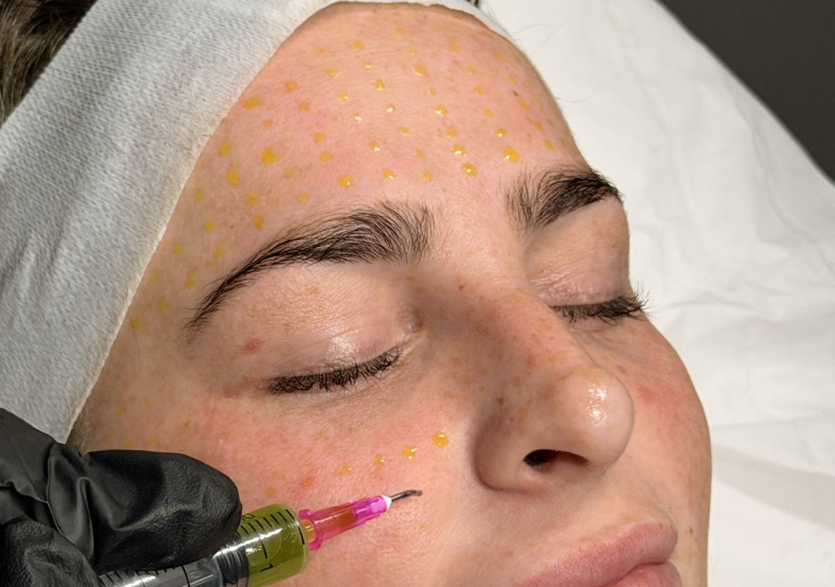 Express Glow Peel | Solène Skin