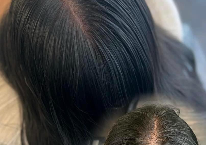 SCALP Micropigmentation Density ( SMP) ( For Women only)