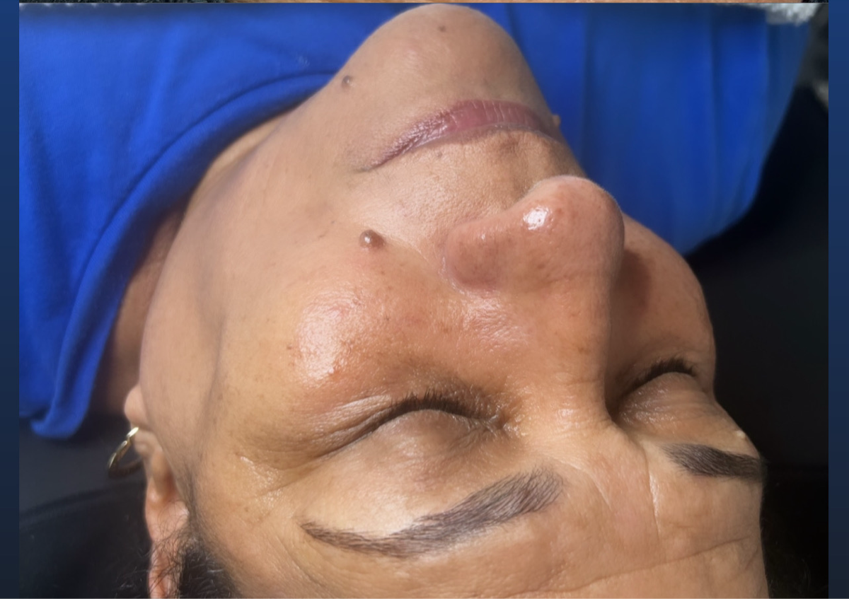 Facial De Limpieza Profunda