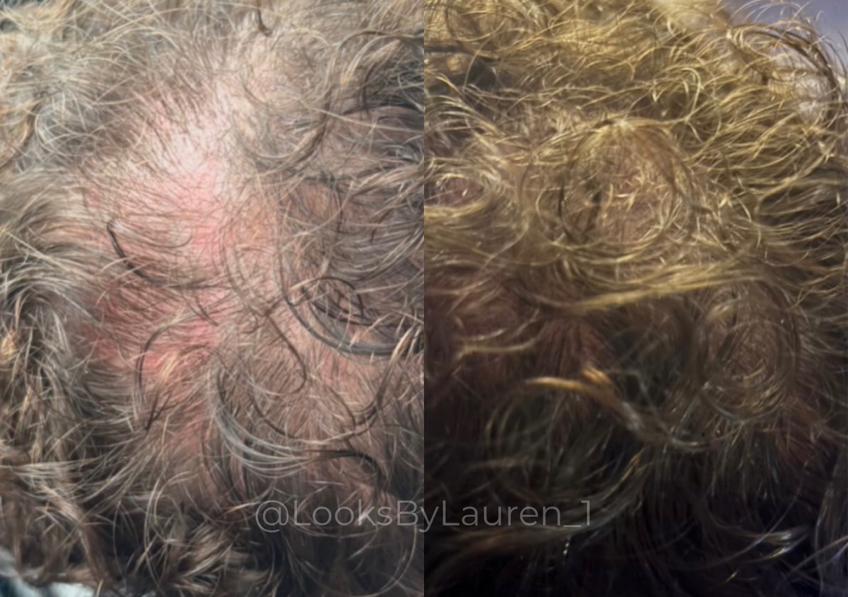 Million Dollar Hair rejuvenation 