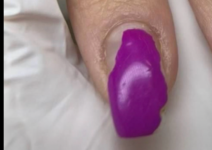 Nail Repair 