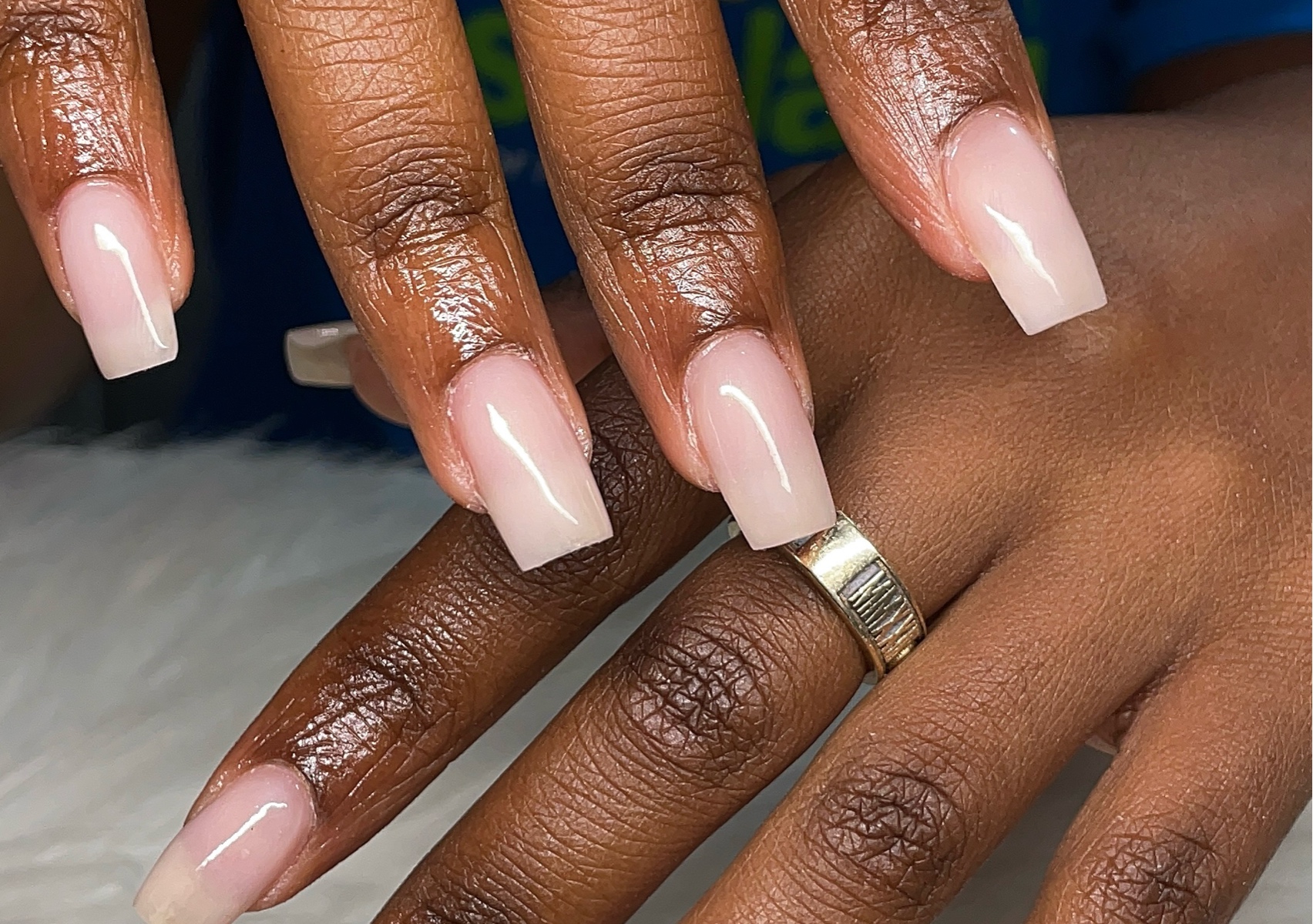 Structured gel fill - one color