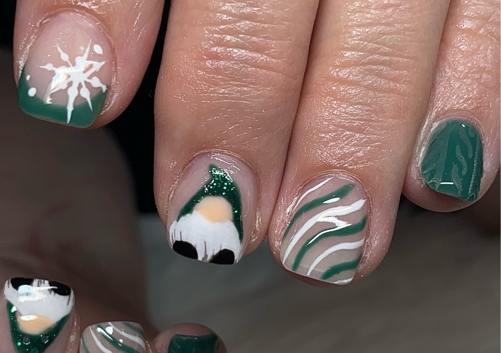 Acrylic overlay fill - with designs