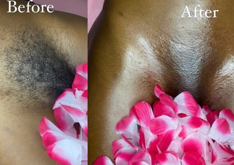 Classic Brazilian Wax