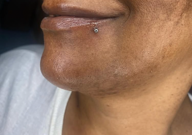 Labret & Side Labret