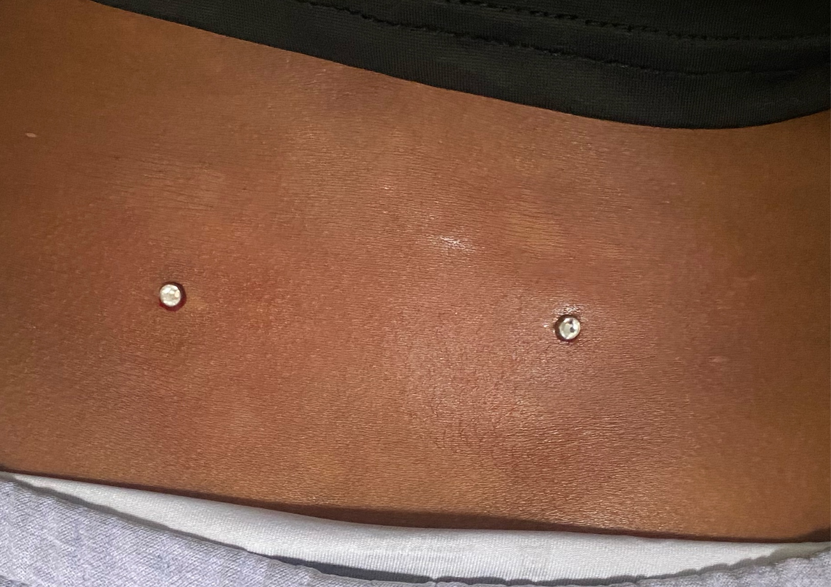 Back Dermals