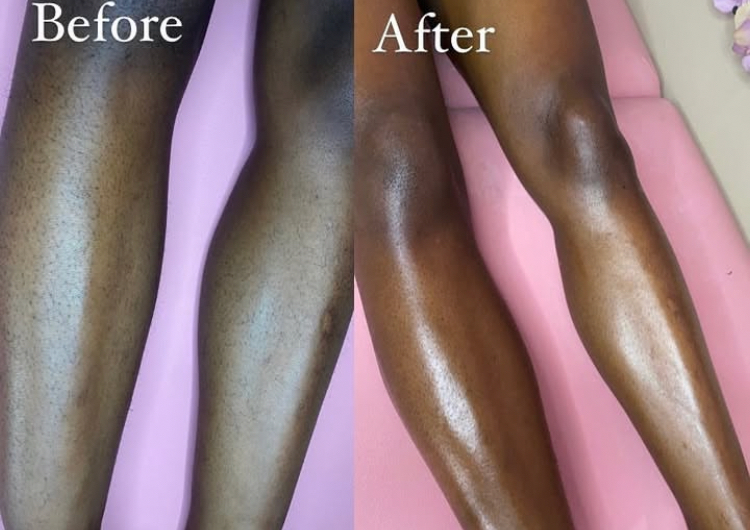 Half Leg (Knee To Calf)