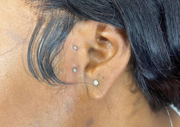 Surface Tragus (one)