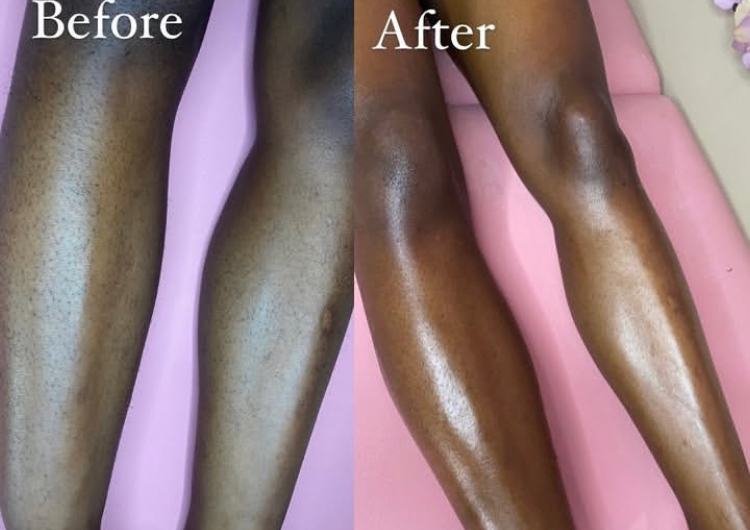 Full Leg (Thigh To Calf)