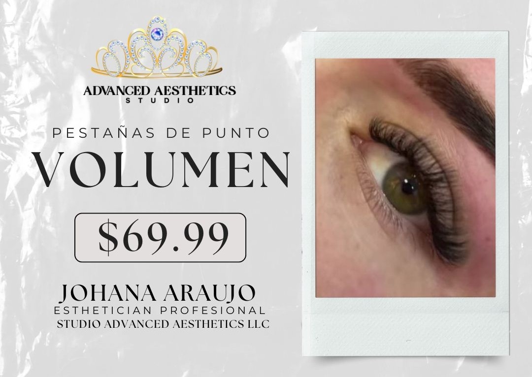 Volumen -  Extensiones de Punto 