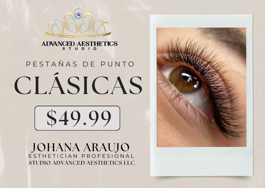 Clásicas - Extensiones de Punto 